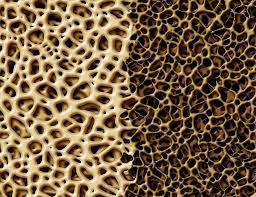 bone tissue