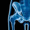 hip x-ray