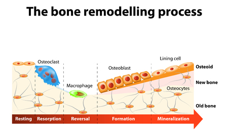 bone remodelng