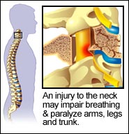 An injury to the neck may impair breathing and paralyze arms, legs, and trunk.